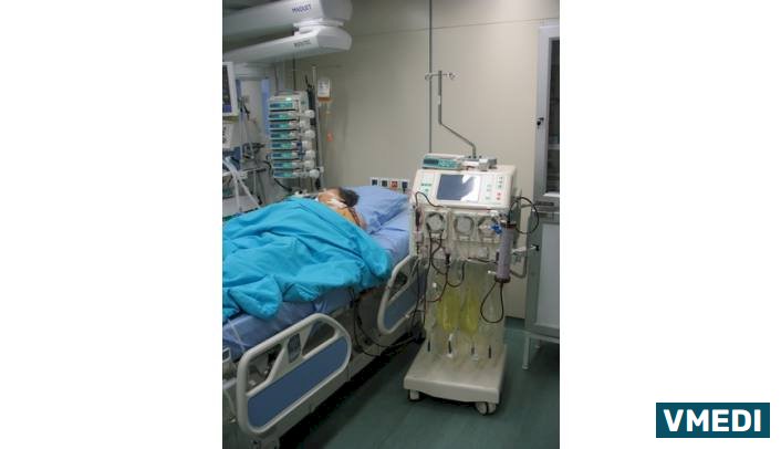 Центр Экстракорпоральной Детоксикации